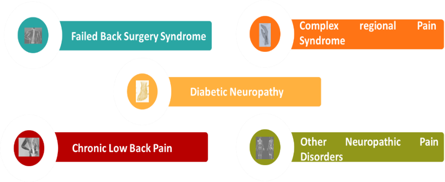 Mechanisms of Neuromodulation