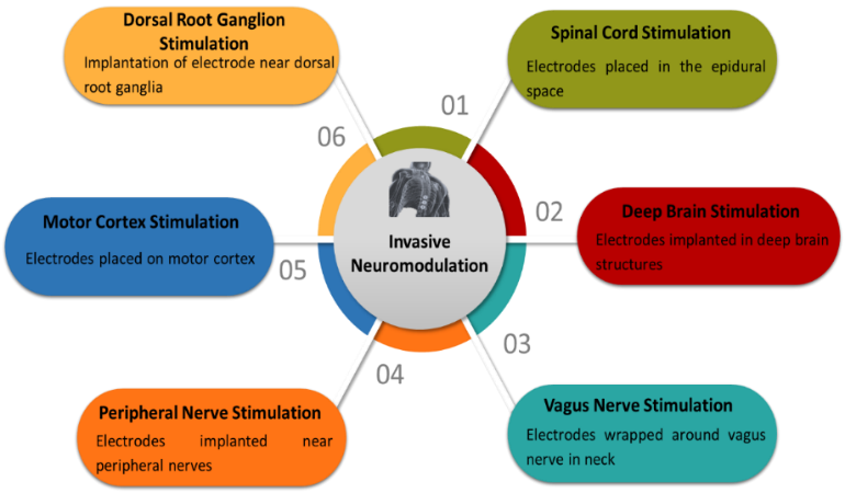 Mechanisms of Neuromodulation