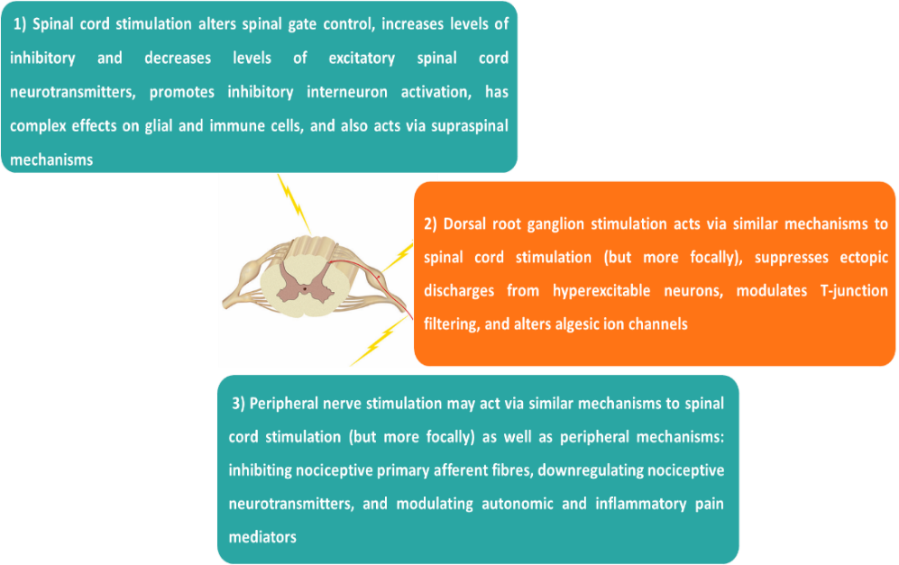 Mechanisms of Neuromodulation
