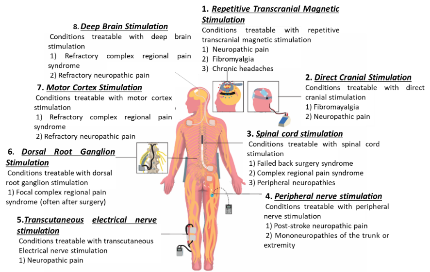 Mechanisms of Neuromodulation